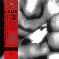 Lame – Lo Que Extrañas Ya No Existe LP